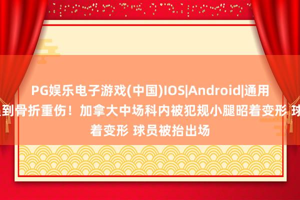 PG娱乐电子游戏(中国)IOS|Android|通用APP下载 遇到骨折重伤！加拿大中场科内被犯规小腿昭着变形 球员被抬出场